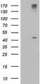 1-Acylglycerol-3-Phosphate O-Acyltransferase 5 antibody, TA504143, Origene, Western Blot image 