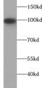Vav Guanine Nucleotide Exchange Factor 2 antibody, FNab09378, FineTest, Western Blot image 