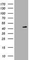 Parvin Beta antibody, TA505715AM, Origene, Western Blot image 