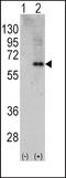 Protein Kinase AMP-Activated Catalytic Subunit Alpha 2 antibody, PA5-14306, Invitrogen Antibodies, Western Blot image 