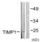 TIMP Metallopeptidase Inhibitor 1 antibody, SPC-1289D-HRP, StressMarq, Western Blot image 