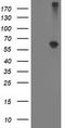 Alcohol Dehydrogenase 1B (Class I), Beta Polypeptide antibody, LS-C172775, Lifespan Biosciences, Western Blot image 