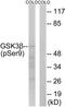 Glycogen Synthase Kinase 3 Beta antibody, TA313126, Origene, Western Blot image 