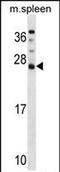 DnaJ Heat Shock Protein Family (Hsp40) Member C5 Beta antibody, PA5-72029, Invitrogen Antibodies, Western Blot image 