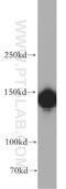 Diaphanous Related Formin 1 antibody, 20624-1-AP, Proteintech Group, Western Blot image 