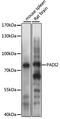 Peptidyl Arginine Deiminase 2 antibody, 14-111, ProSci, Western Blot image 