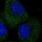 Telomere Maintenance 2 antibody, HPA041348, Atlas Antibodies, Immunofluorescence image 