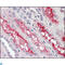FER Tyrosine Kinase antibody, LS-C812596, Lifespan Biosciences, Immunohistochemistry paraffin image 