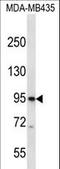 Cyclic Nucleotide Gated Channel Beta 3 antibody, LS-C168877, Lifespan Biosciences, Western Blot image 