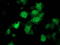 Chromosome 1 Open Reading Frame 50 antibody, TA502912, Origene, Immunofluorescence image 