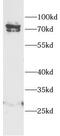 Proprotein Convertase Subtilisin/Kexin Type 4 antibody, FNab10362, FineTest, Western Blot image 