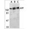 Amyloid Beta Precursor Protein antibody, TA306002, Origene, Western Blot image 