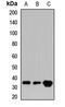 CRK Like Proto-Oncogene, Adaptor Protein antibody, orb411611, Biorbyt, Western Blot image 