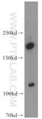 Adenylate cyclase type 1 antibody, 55067-1-AP, Proteintech Group, Western Blot image 