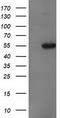 Cytosolic beta-glucosidase antibody, LS-C172795, Lifespan Biosciences, Western Blot image 