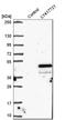 Absent In Melanoma 2 antibody, HPA031365, Atlas Antibodies, Western Blot image 