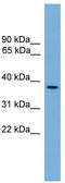 Chromosome 14 Open Reading Frame 28 antibody, TA339961, Origene, Western Blot image 
