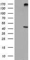 1-Acylglycerol-3-Phosphate O-Acyltransferase 5 antibody, TA504145, Origene, Western Blot image 