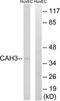 Carbonic anhydrase 3 antibody, TA313538, Origene, Western Blot image 