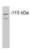 Coatomer Protein Complex Subunit Beta 1 antibody, GTX22915, GeneTex, Western Blot image 