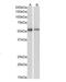 Fas Associated Factor Family Member 2 antibody, NB100-1296, Novus Biologicals, Western Blot image 