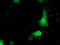 Phenylethanolamine N-methyltransferase antibody, LS-C172926, Lifespan Biosciences, Immunofluorescence image 