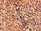 Zinc Finger Protein 155 antibody, orb352317, Biorbyt, Immunohistochemistry paraffin image 