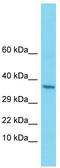 Chitobiosyldiphosphodolichol beta-mannosyltransferase antibody, TA331033, Origene, Western Blot image 