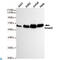 SMAD2 antibody, LS-C813117, Lifespan Biosciences, Western Blot image 