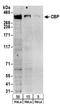 CREB Binding Protein antibody, A300-363A, Bethyl Labs, Western Blot image 