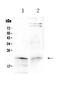 HGb antibody, PA5-79122, Invitrogen Antibodies, Western Blot image 