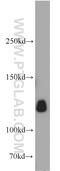 Kinesin Family Member 5A antibody, 21186-1-AP, Proteintech Group, Western Blot image 