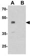 UbiA prenyltransferase domain-containing protein 1 antibody, GTX32134, GeneTex, Western Blot image 