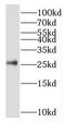 Serine And Arginine Rich Splicing Factor 9 antibody, FNab07794, FineTest, Western Blot image 