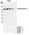 Suppression Of Tumorigenicity 14 antibody, A300-221A, Bethyl Labs, Immunoprecipitation image 
