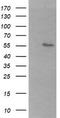 Beta-1,3-N-Acetylgalactosaminyltransferase 2 antibody, CF505973, Origene, Western Blot image 