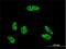 Vacuolar Protein Sorting 72 Homolog antibody, H00006944-M01, Novus Biologicals, Immunocytochemistry image 