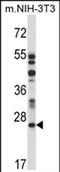 Lysosomal-associated transmembrane protein 4A antibody, PA5-71850, Invitrogen Antibodies, Western Blot image 