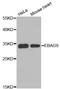 Receptor-binding cancer antigen expressed on SiSo cells antibody, STJ110683, St John