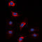 Coagulation Factor XIII B Chain antibody, LS-C358977, Lifespan Biosciences, Immunofluorescence image 