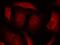 Forkhead Box O3 antibody, NB100-81929, Novus Biologicals, Immunocytochemistry image 