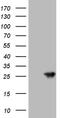 Aralkylamine N-Acetyltransferase antibody, M03784, Boster Biological Technology, Western Blot image 