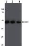 Zinc Finger DHHC-Type Containing 9 antibody, A08064, Boster Biological Technology, Western Blot image 