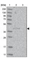 Retroviral-like aspartic protease 1 antibody, PA5-57070, Invitrogen Antibodies, Western Blot image 