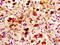 Mannan Binding Lectin Serine Peptidase 2 antibody, CSB-PA013510LA01HU, Cusabio, Immunohistochemistry frozen image 