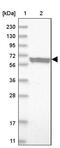 Elongator Acetyltransferase Complex Subunit 3 antibody, PA5-55260, Invitrogen Antibodies, Western Blot image 