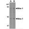 Solute Carrier Family 9 Member A1 antibody, MBS150683, MyBioSource, Western Blot image 