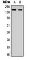 Ankyrin Repeat Domain 30A antibody, orb235011, Biorbyt, Western Blot image 