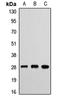 ETHE1 Persulfide Dioxygenase antibody, orb411679, Biorbyt, Western Blot image 