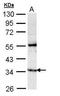GTPase, IMAP Family Member 5 antibody, GTX108652, GeneTex, Western Blot image 